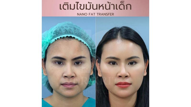 รีวิวรูปภาพ